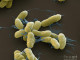 plague-bacteria-yersinia-pestis-sem-eye-of-science