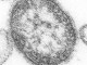 1200px-Measles_virus